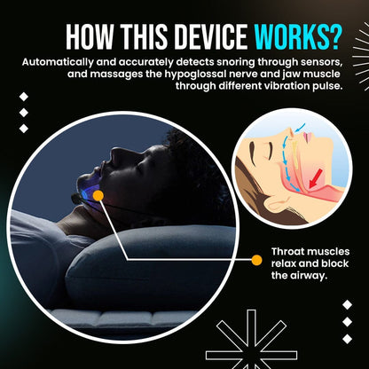 KISSHI™ Smart EMS Anti-Snoring Device